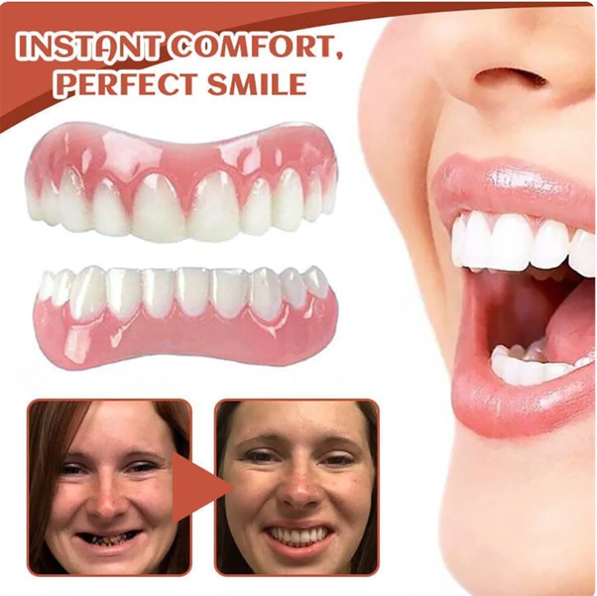 Silicone Denture Reline Kit 1 Set L863