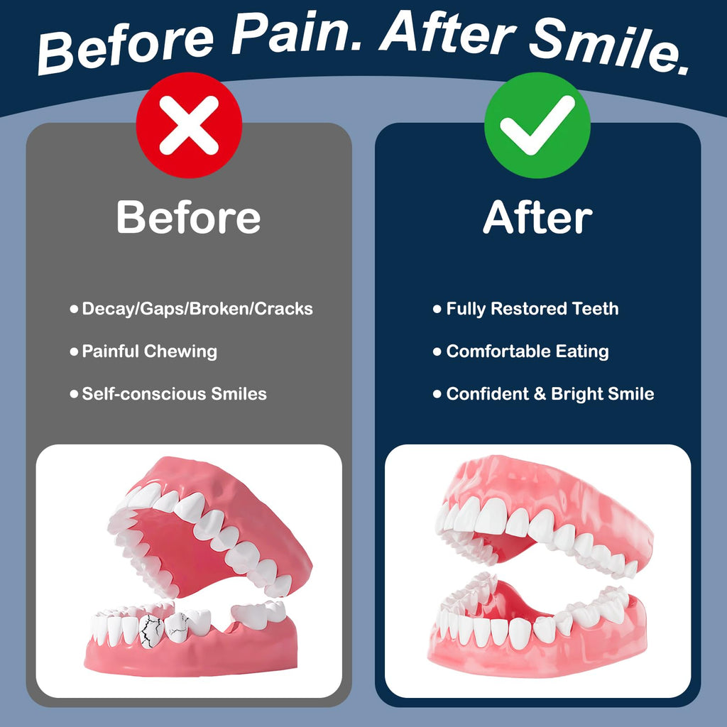 Denture Repair Glue 1oz Fast-Setting Adhesive E935