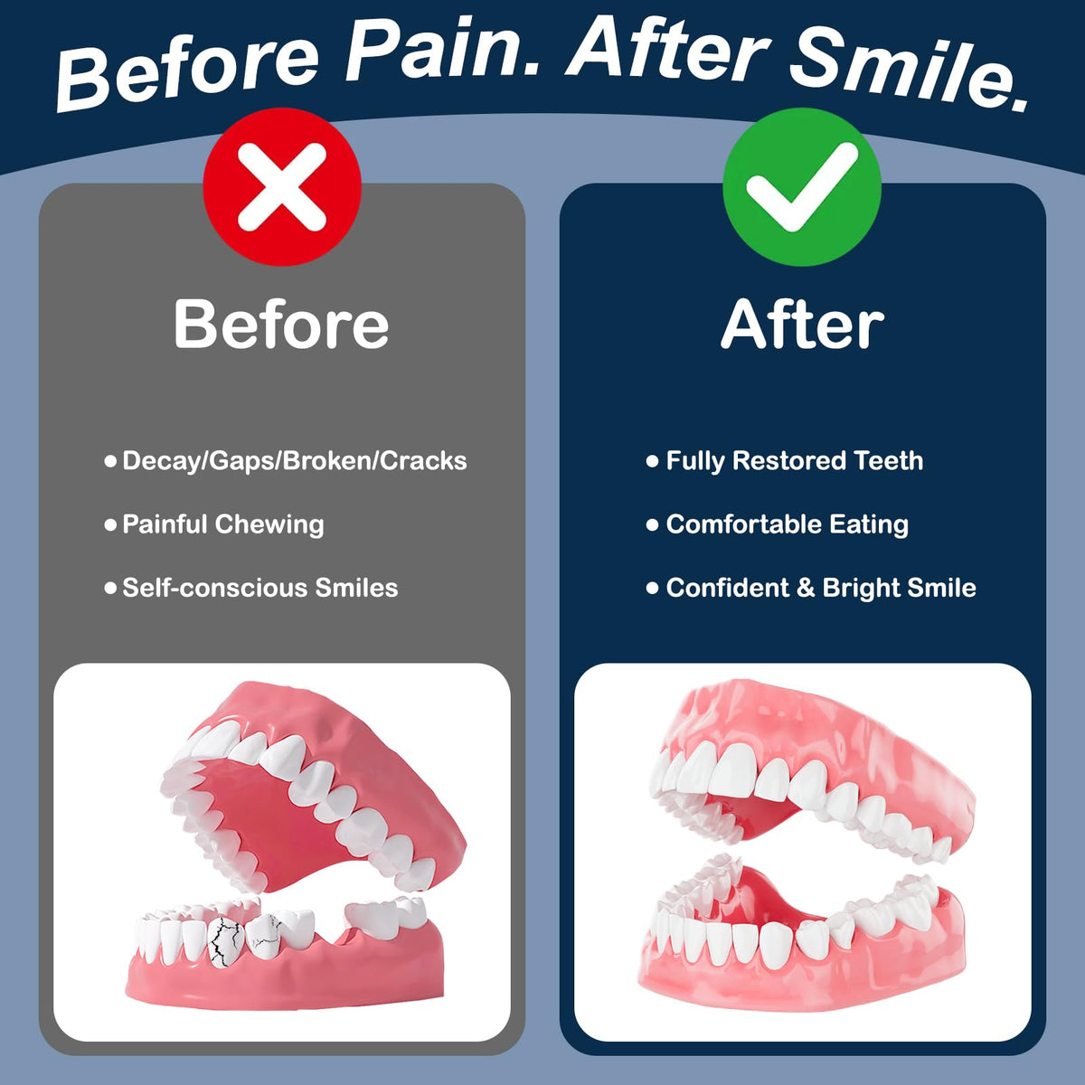 Denture Repair Glue 1oz Fast-Setting Adhesive E935